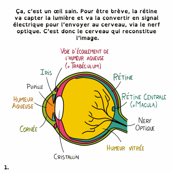 Déficiences visuelles - Marie Massonneau, orthoptiste - Vulgarisation - BD - Djoune Illustrations - Justine Gisdal Molron