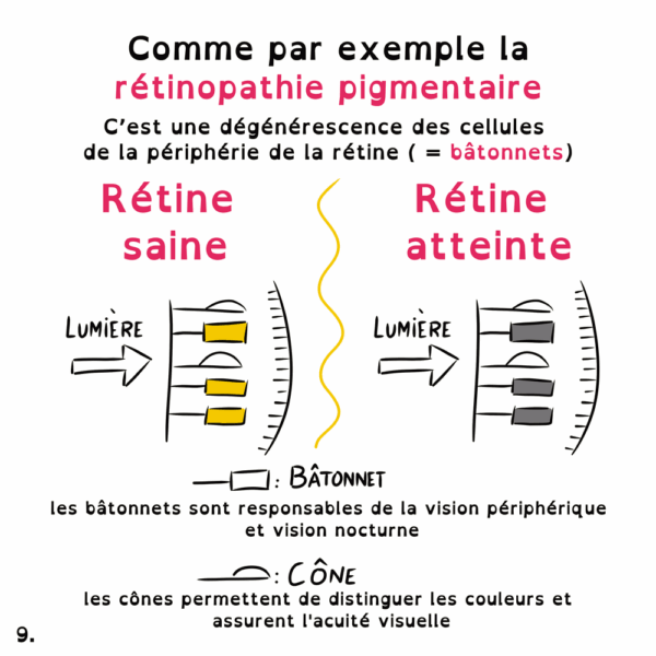 Déficiences visuelles - Marie Massonneau, orthoptiste - Vulgarisation - BD - Djoune Illustrations - Justine Gisdal Molron