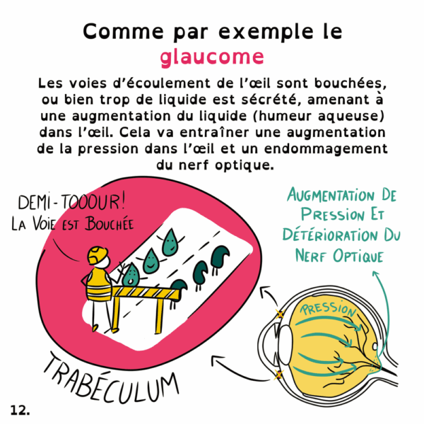 Déficiences visuelles - Marie Massonneau, orthoptiste - Vulgarisation - BD - Djoune Illustrations - Justine Gisdal Molron